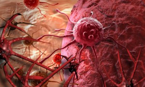 Что может уничтожить раковые клетки?
